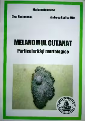Melanomul cutanat. Particularitati morfologice