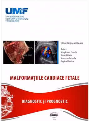 Malformatii cardiace fetale