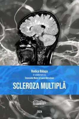 Scleroza multipla (print color)