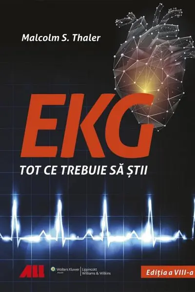 EKG. Tot ce trebuie sa stii
