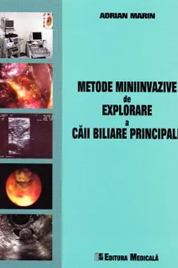 Metode miniinvazive de explorare a căii biliare principale