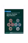 Atlas of Vitrified Blastocysts in Human Assisted Reproduction - Thomas Ebner, Pierre Vanderzwalmen, Barbara Wirleitner
