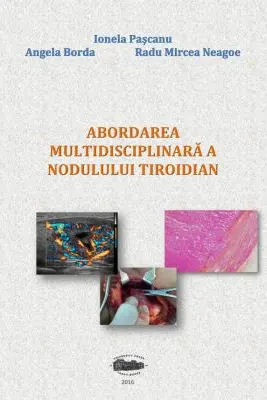 Abordarea multidisciplinara a nodulului tiroidian