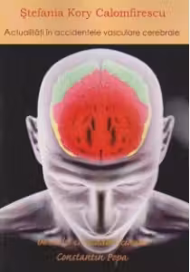 Actualitati in accidentele vasculare cerebrale