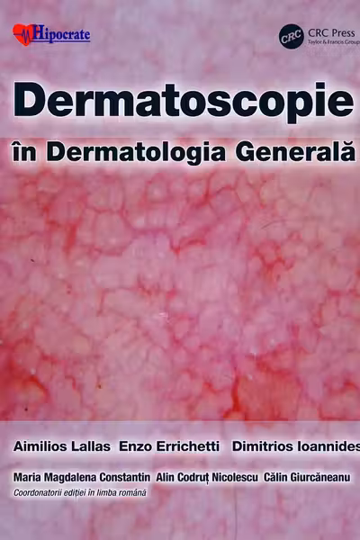 Dermatoscopie în Dermatologia Generală
