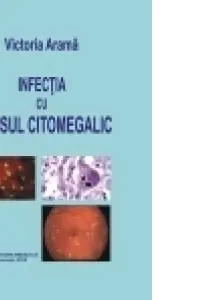 Infecția cu virusul citomegalic
