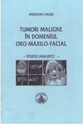 Tumori maligne in domeniul oro-maxilo-facial