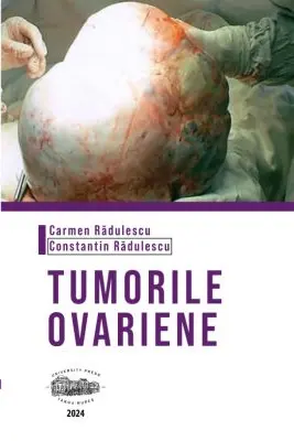 Tumorile ovariene (color) - Carmen Radulescu