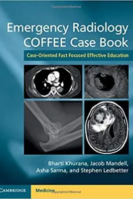 Emergency Radiology COFFEE Case Book: Case-Oriented Fast Focused Effective Education - Bharti Khurana, Jacob Mandell, Asha Sarma, Stephen Ledbetter