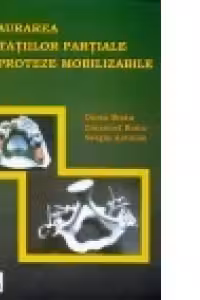 Restaurarea edentatiilor partiale prin proteze mobilizabile