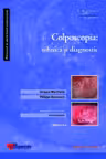 Colposcopia: tehnica și diagnostic