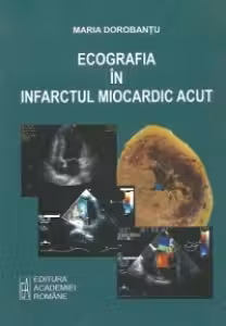 Ecografia in infarctul miocardic acut