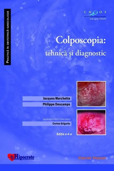 Colposcopia: tehnica și diagnostic