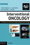 Interventional Oncology: Principles and Practice of Image-Guided Cancer Therapy - Jean-Francois H. Geschwind, Michael C. Soulen