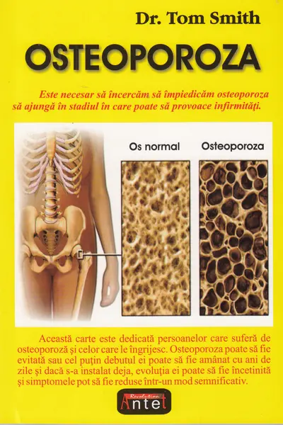 Osteoporoză