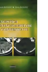Imagistica meningioamelor de convexitate