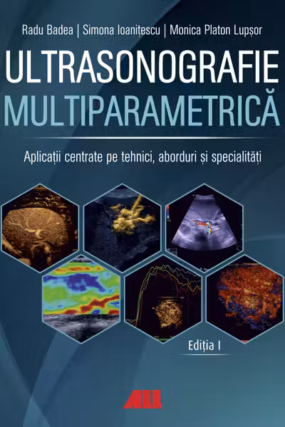 Ultrasonografie multiparametrica