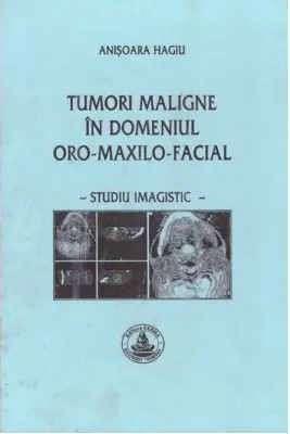 Tumori maligne in domeniul oro-maxilo-facial