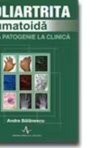 POLIARTRITA REUMATOIDA - de la patogenie la clinica