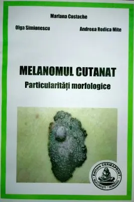 Melanomul cutanat. Particularitati morfologice