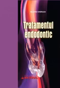 Tratamentul Endodontic