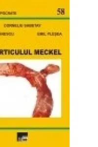 Diverticulul Meckel - Corneliu Sabetay, Ligia Stanescu, Emil Plesea