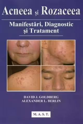 Acneea si rozaceea Manifestari deagnostic