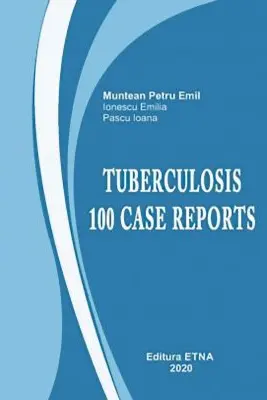 Tuberculosis. 100 cases
