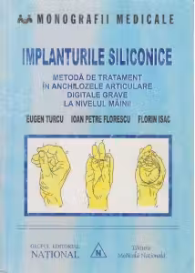 Implanturile siliconice. Metoda de tratament in anchilozele articulare digitale grave la nivelul mainii