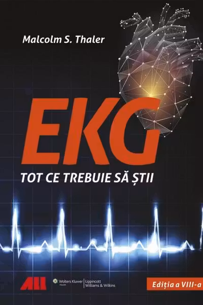 EKG. Tot ce trebuie sa stii