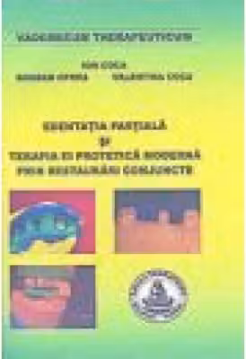 Edentatia partiala si terapia ei protetica moderna prin restaurari conjuncte