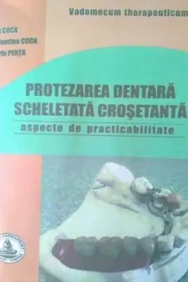 Protezarea dentara scheletata crosetanta. Practibilitate