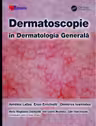 Dermatoscopie în Dermatologia Generală