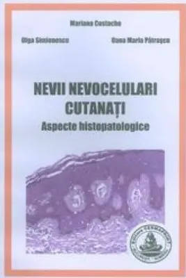 Nevii nevocelulari cutanati. Aspecte histopatologice