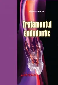 Tratamentul Endodontic