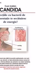 Cum tratam candida