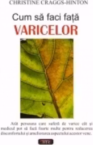 Cum să faci față varicelor