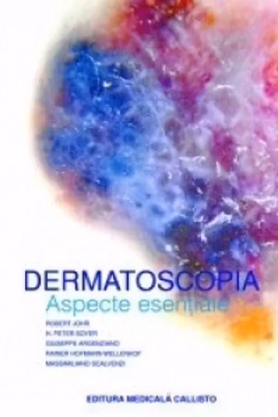 Dermatoscopia. Aspecte esențiale