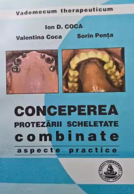 Conceperea protezarii scheletate combinate