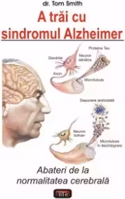A trai cu sindromul Alzheimer