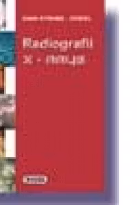 Radiografii / X-Rays. Editie Bilingva