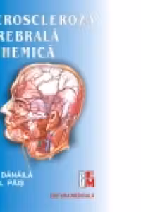 Ateroscleroza cerebrala ischemica