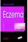 Eczema