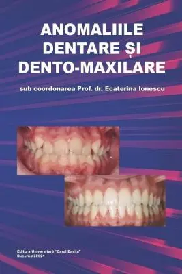 Anomaliile dentare si dento-maxilare
