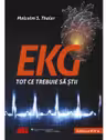 EKG. Tot ce trebuie sa stii