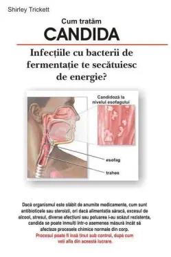Cum tratam candida