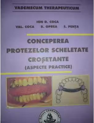 Conceperea protezelor scheletate crosetante