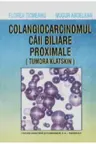 Colangiocarcinomul cailor biliare