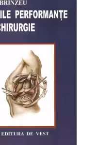 Marile performante in chirurgie