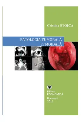 Patologia tumorala etmoidala. Strategii actuale in diagnostic si tratament - Cristina Stoica